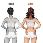 Dispositif de traction cervicale, support de cou gonflable